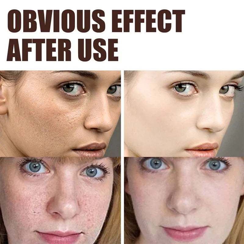 Retinol Anti-aging Wrinkle Remover Face Cream